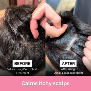 FUL Detox Scalp Treatment 150ml– Relief for Dry, Flaky or Itchy Scalps | Clarifying & Hydrating - The LTL Shop